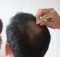 Cum să previi căderea părului și să obții un păr sănătos și strălucitor