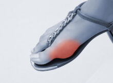 Sandale ortopedice: Pentru cine sunt destinate și cum pot fi de ajutor